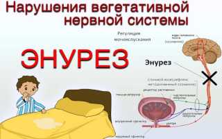 Энурез у ребенка. Причины и лечение энуреза у детей
