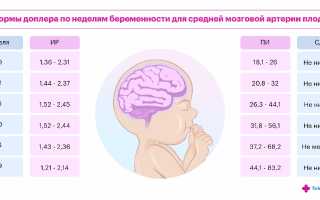 Сосуды пуповины и синдром ЕАП: строение в норме, чем опасны отклонения на допплерометрии
