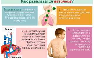 Ветряная оспа у ребенка. Причины, симптомы и лечение ветрянки у детей
