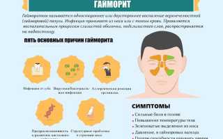 Гайморит у ребенка. Причины, симптомы, лечение и профилактика гайморита