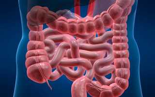 Боль в кишечнике: причины, лечение, какой врач лечит