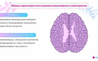 Лейкоареоз: что это, причины, признаки, лечение, формы, прогноз