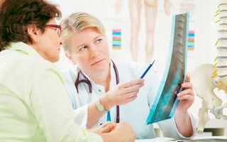 Вертебролог: что лечит этот врач?