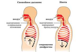 Икота у ребенка. Причины. Как избавиться от икоты?
