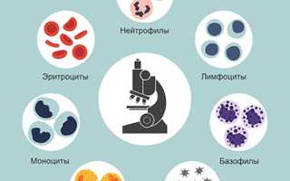 Клинический анализ крови: от светового микроскопа к гематологическим анализаторам