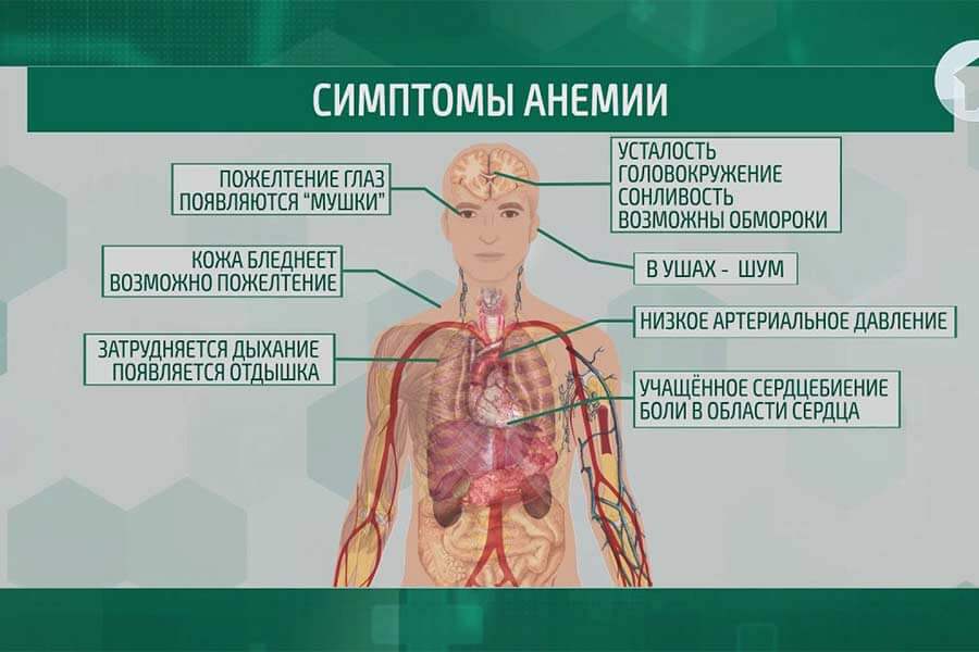 Симптомы анемии