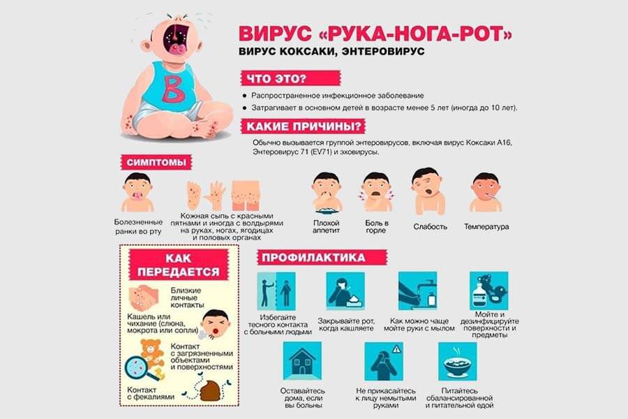 Симптомы вируса Коксаки
