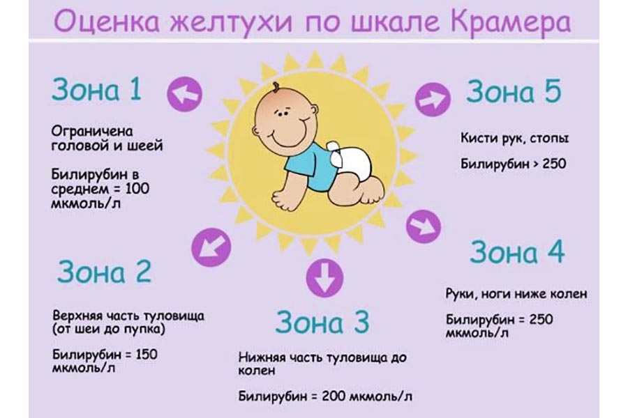 Оценка желтухи по шкале Крамера