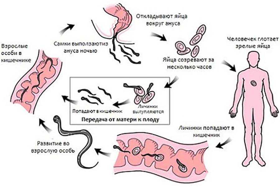 Заражение глистами