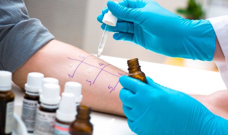 Аллерголог