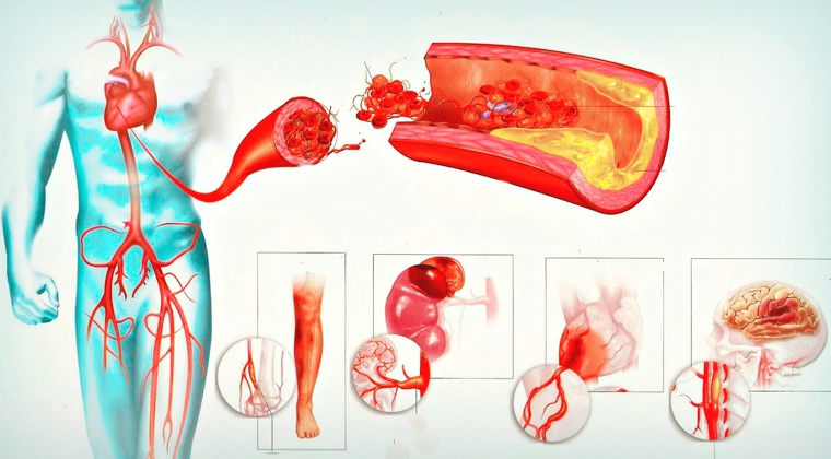 Ангиология