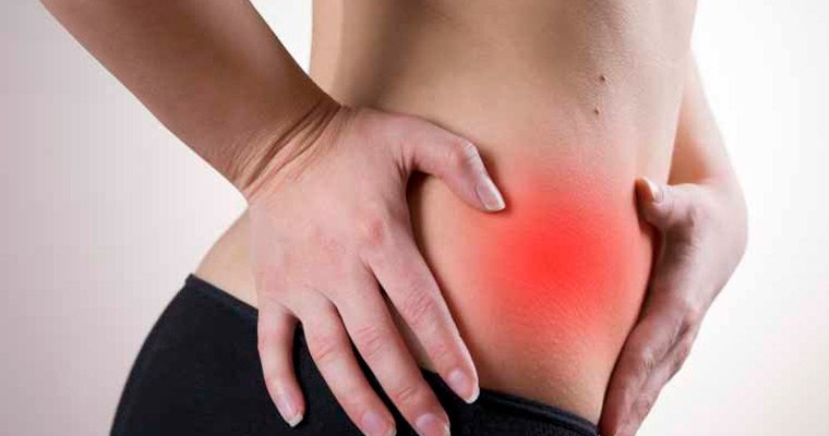 Аппендицит