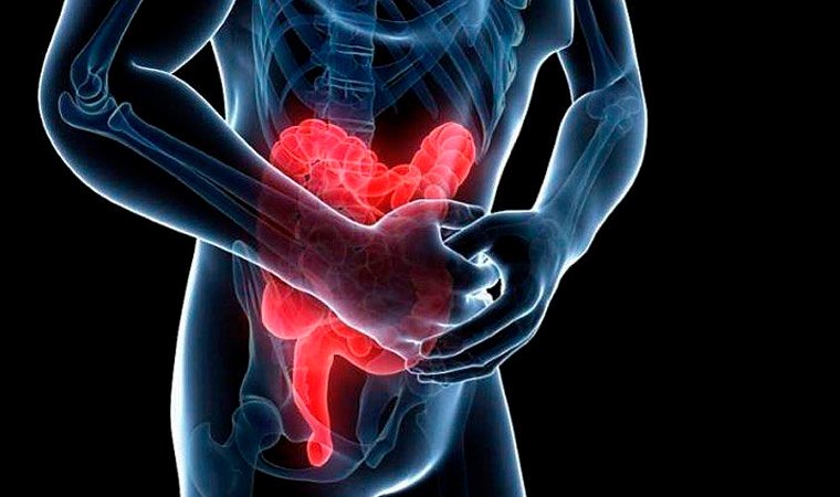 Болезнь Крона