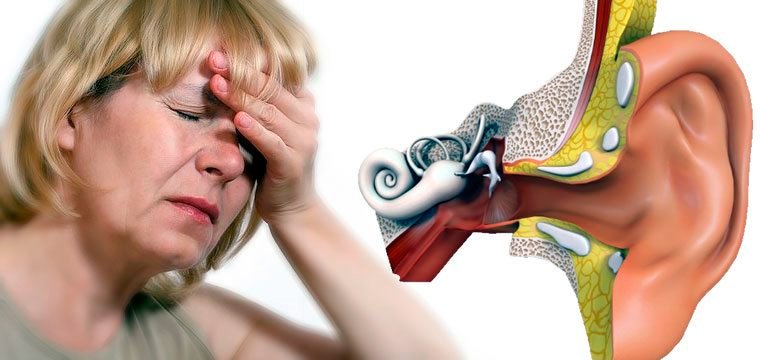 Болезнь Меньера