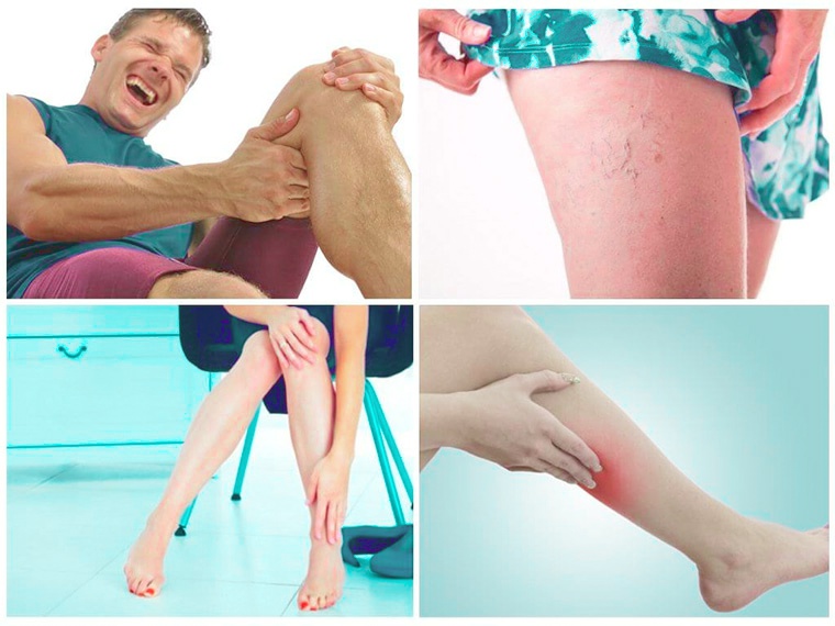 Болезни-которые-лечит-ангиолог