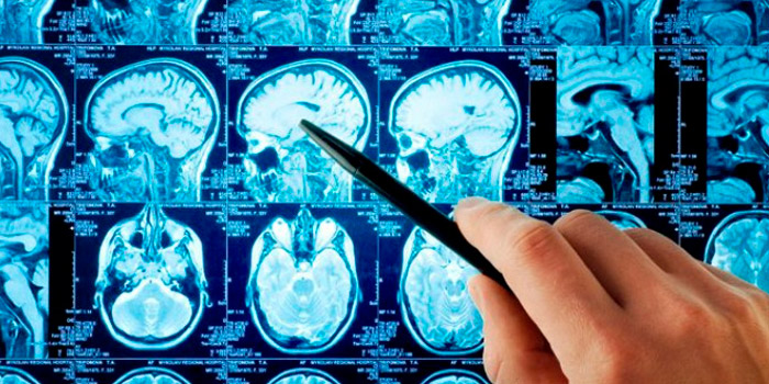 Что лечит нейрохирург