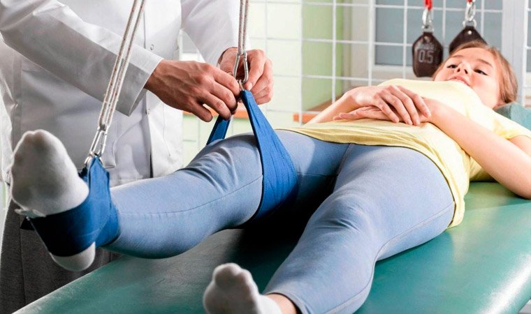 Детский травматолог