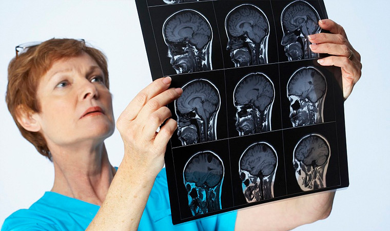 Диагностика головной боли