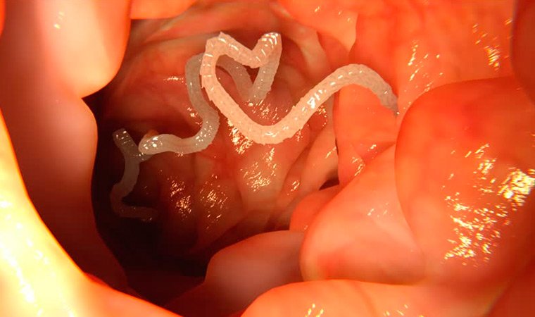 Гельминтозы