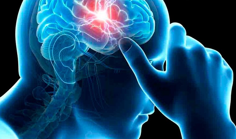 Головная боль