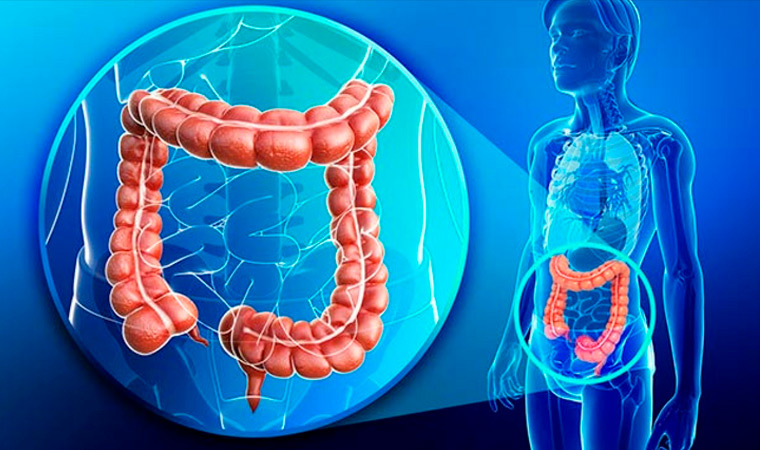 Кишечная непроходимость