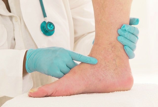 Когда-обращаться-к-ангиологу