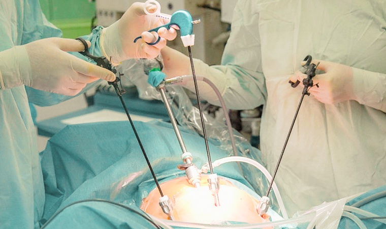 Лечение паховой грыжи