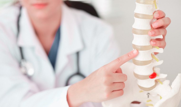Лечение позвоночника