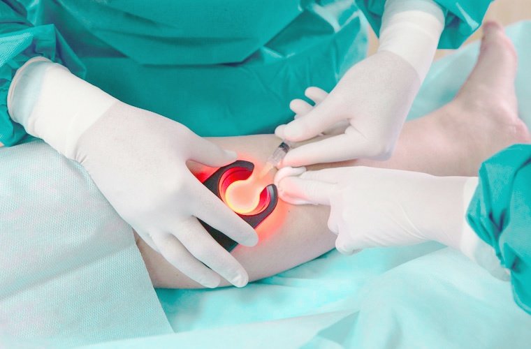 Лечение-у-ангиолога