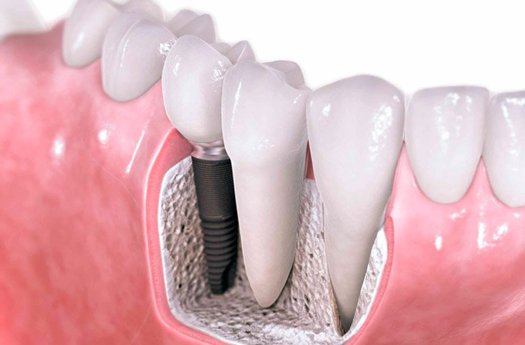 Методы лечения стоматолога