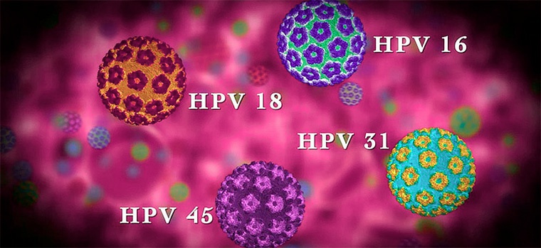 Папиллома и онкология