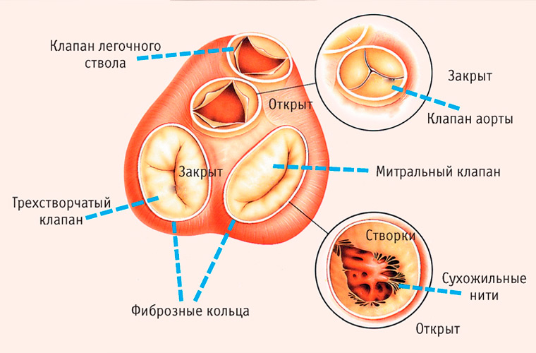 Патологии сердца