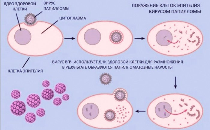 Причины папилллом
