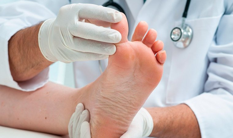 Прием у миколога