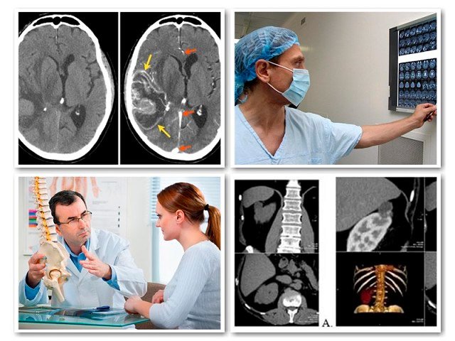 Прием у нейрохирурга