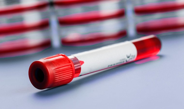Пробирка с кровью