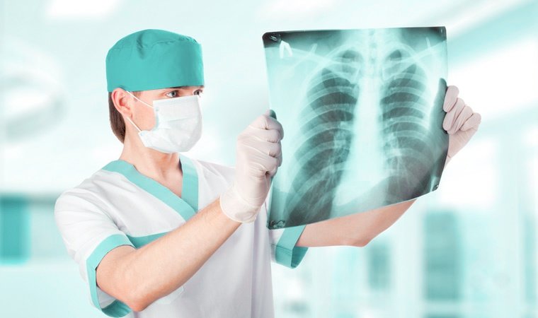 Рентгенография