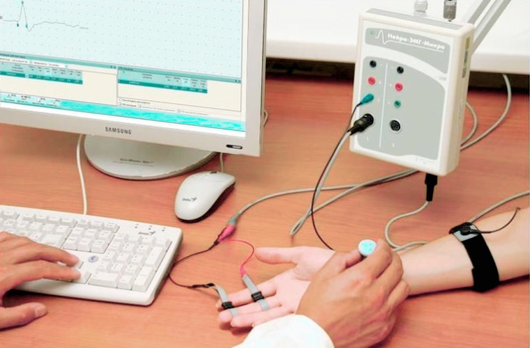 Реовазография