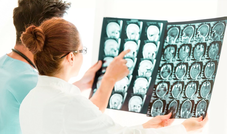 Результаты-МРТ