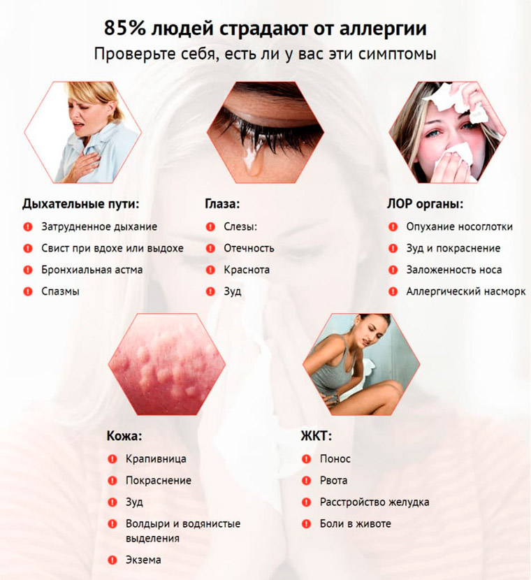 Симптомы аллергии