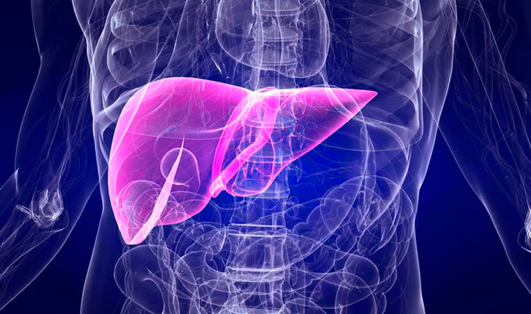 Цирроз печени