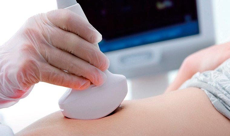 Ультразвуковое исследование