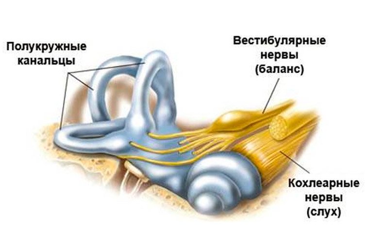 Возникновение болезни Мейнера