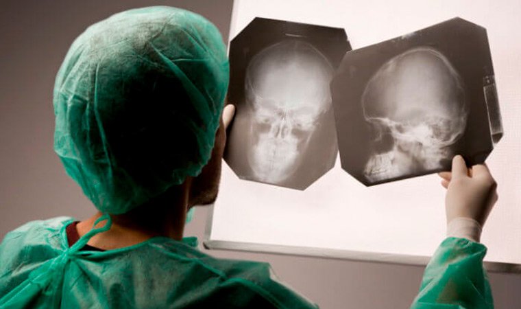 Вторичные головные боли