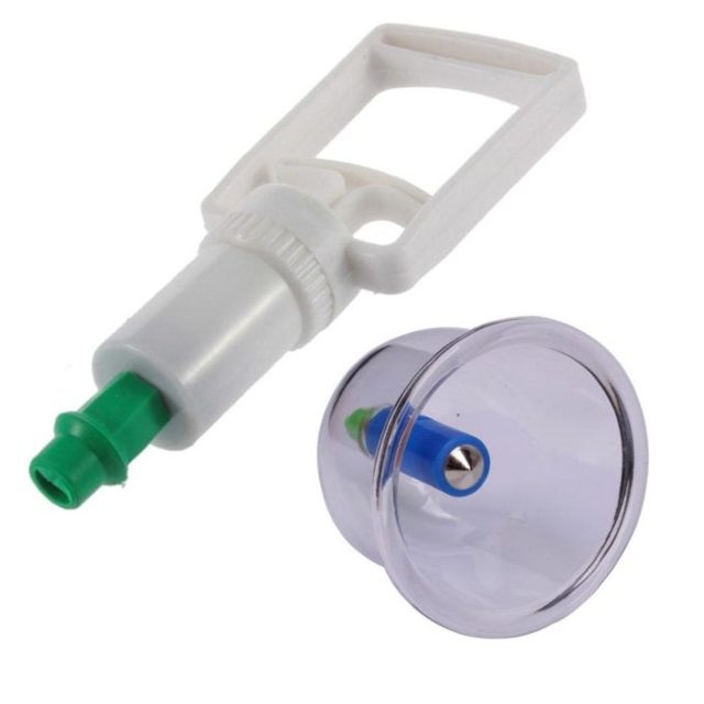 Банки при кашле: как правильно ставить в домашних условиях и сколько держать