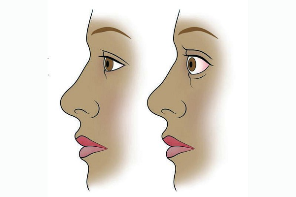 Визуализация болезни Грейвса