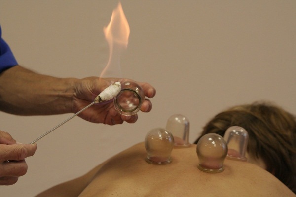 Банки на спину. Польза и вред при кашле, остеохондрозе, грыже позвоночника, как ставить