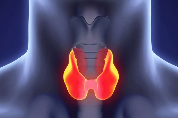 Гипотиреоз