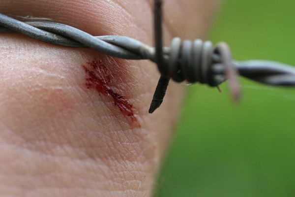 Что представляет собой столбняк