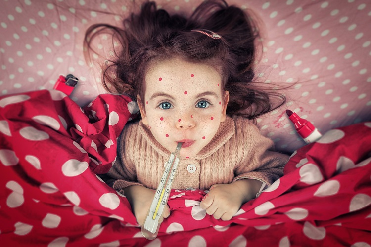 Корь у ребенка